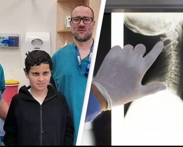 Az orvosok sikeresen visszavarrják a fiú fejét, miután lefejezték egy autóbalesetben