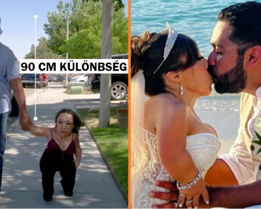 A férfinak azt mondják, hogy a szerelme „undorító” a kinézete miatt, feleségül veszi annak ellenére, hogy a család „hülyének” nevezte őt A férfinak azt mondják, hogy a szerelme „undorító” a kinézete miatt, feleségül veszi annak ellenére, hogy a család „hülyének” nevezte őt
