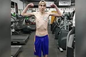 A rákos és cisztás fibrózisban szenvedő fiatalember fitneszbálvánnyá változik.