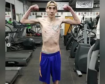 A rákos és cisztás fibrózisban szenvedő fiatalember fitneszbálvánnyá változik.