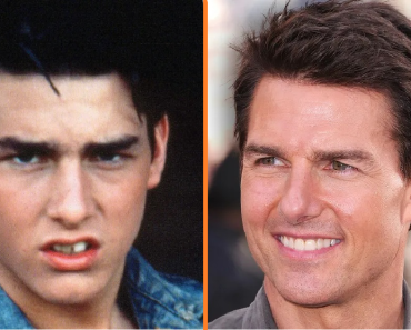 Tom Cruise „görbe” fog átalakulása vitát vált ki, egy másik ikon „új” fogai lenyűgözték a rajongókat Tom Cruise „görbe” fog átalakulása vitát vált ki, egy másik ikon „új” fogai lenyűgözték a rajongókat