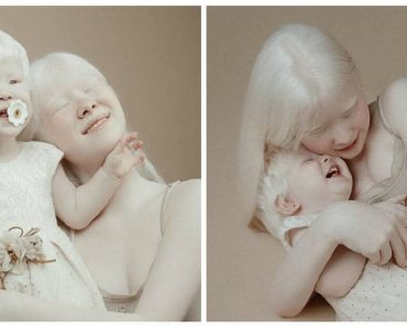A 12 év különbséggel született albínó testvérek az egész világot lenyűgözték rendkívüli szépségükkel
