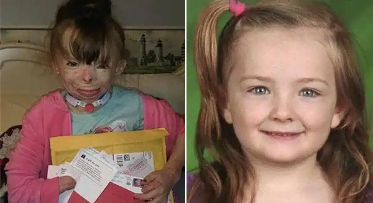A kislány, aki túlélte a tüzet, több mint 700 000 karácsonyi képeslapot kapott