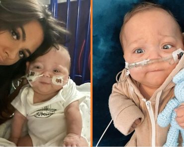 Túlélte a 17 hetes koraszülött baba, miután szülei nem voltak hajlandóak leválasztani a légzőkészülékét